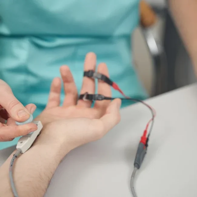 detailed electrode placement on hand for nerve conduction study
