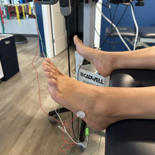 nerve conduction test on foot with electrodes attached Chicago clinic