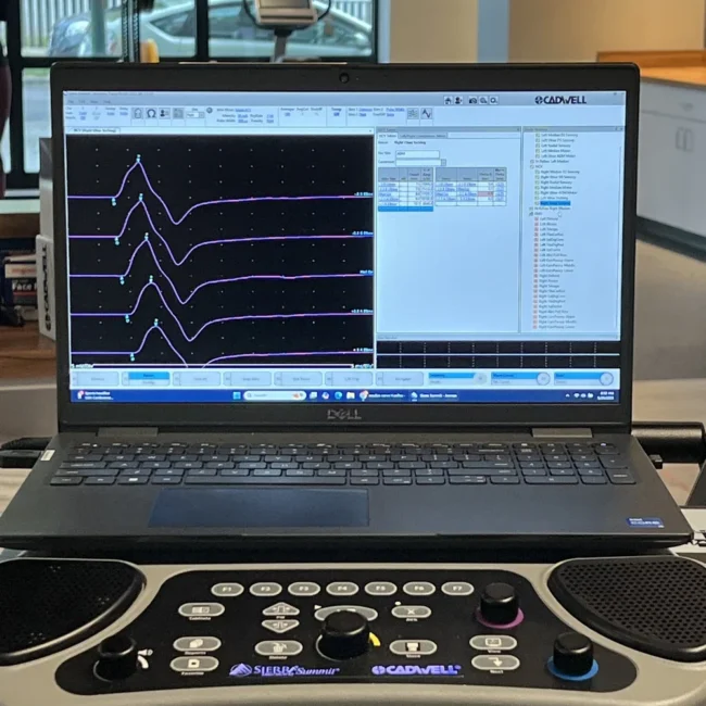 EMG test results displayed on diagnostic machine in Chicago clinic