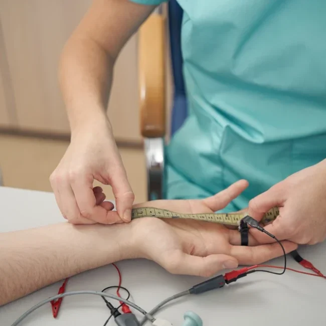 measuring nerve response during NCV test on arm Chicago