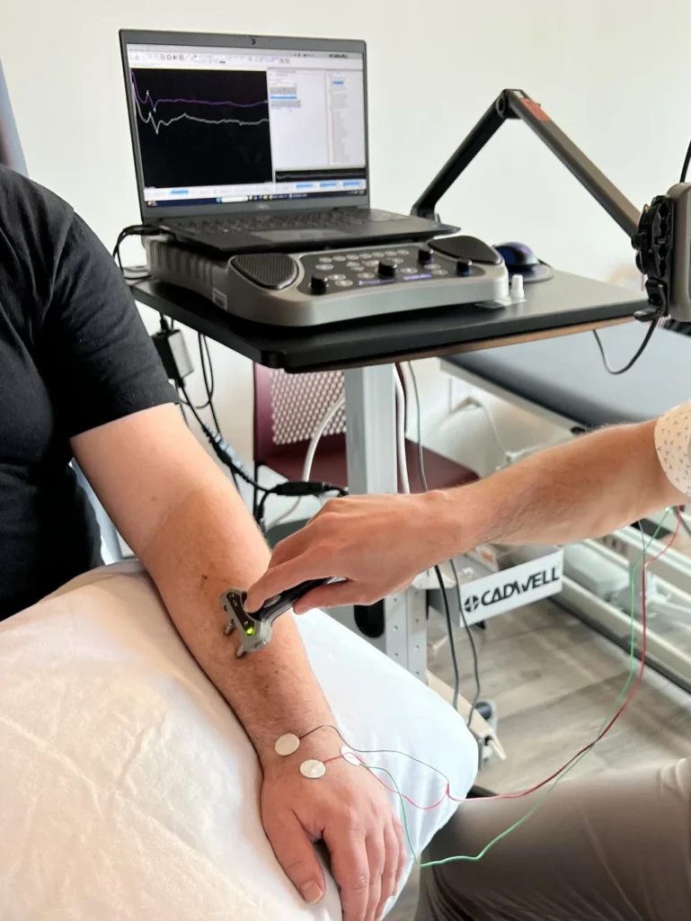 nerve conduction velocity test on arm with electrodes Chicago